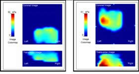 Relatively normal vs abnormal PMI (Custom)